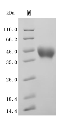(Tris-Glycine gel) Discontinuous SDS-PAGE (reduced) with 5% enrichment gel and 15% separation gel.