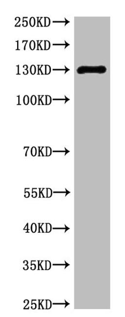 Western blot analysis of Rat Heart Tissue, diluted at 1:1000.