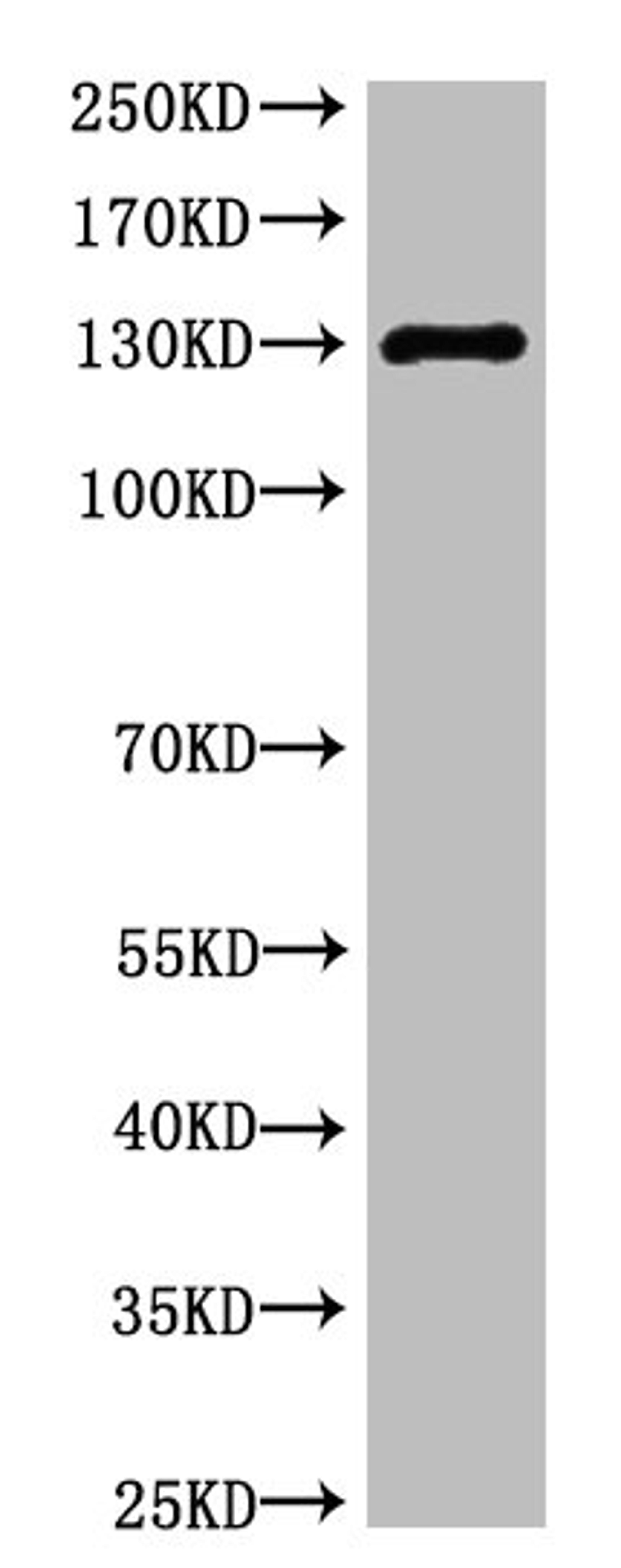 Western blot analysis of Rat Heart Tissue, diluted at 1:1000.