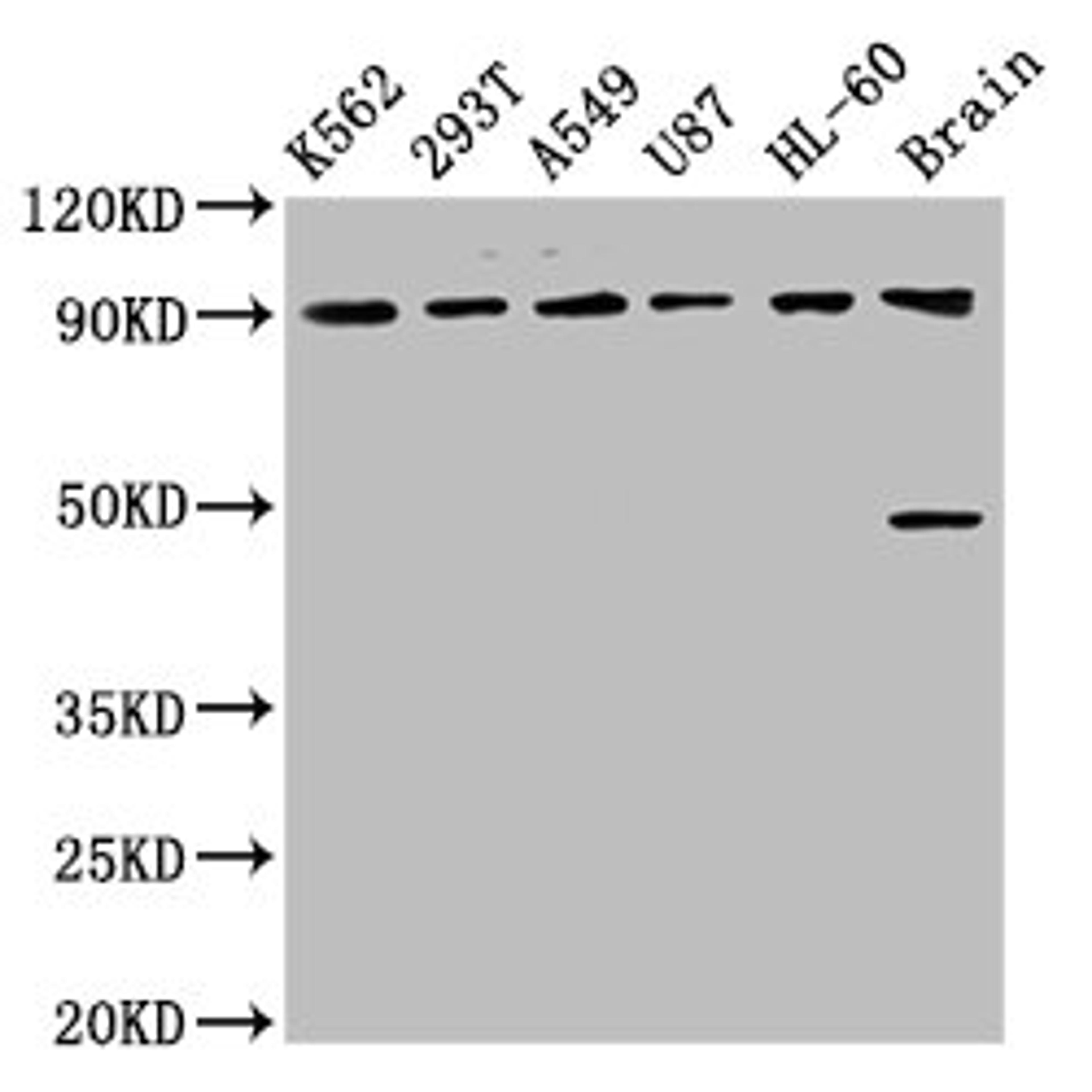 Western Blot. Positive WB detected in: K562 whole cell lysate, 293T whole cell lysate, A549 whole cell lysate, U87 whole cell lysate, HL60 whole cell lysate, Rat brain tissue. All lanes: OCA2 antibody at 8.93µg/ml. Secondary. Goat polyclonal to rabbit IgG at 1/50000 dilution. Predicted band size: 93, 91, 75 kDa. Observed band size: 93 kDa