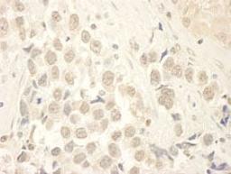 Detection of human HBO by immunohistochemistry.