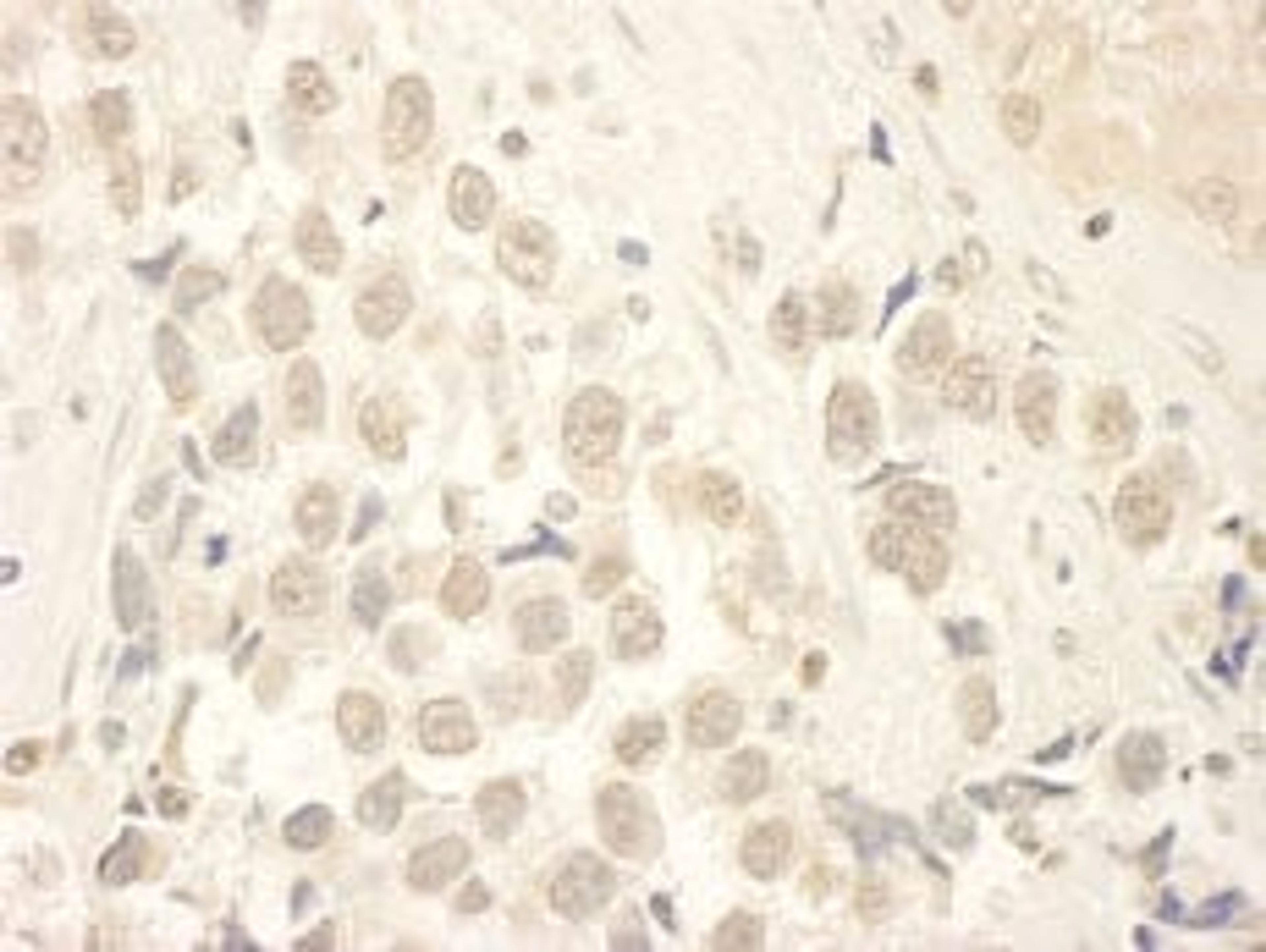 Detection of human HBO by immunohistochemistry.