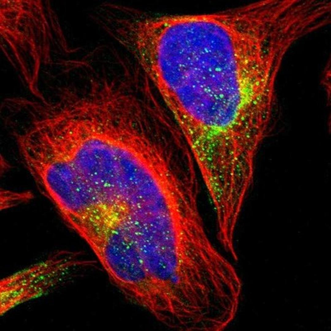 Immunocytochemistry/Immunofluorescence: GRAMD3 Antibody [NBP1-82149] - Staining of human cell line U-2 OS shows positivity in cytoplasm.