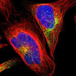 Immunocytochemistry/Immunofluorescence: GRAMD3 Antibody [NBP1-82149] - Staining of human cell line U-2 OS shows positivity in cytoplasm.