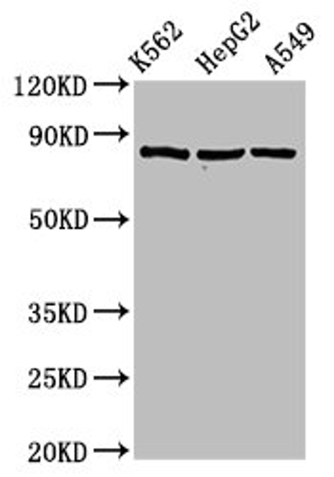 Western Blot. Positive WB detected in: K562 whole cell lysate, HepG2 whole cell lysate, A549 whole cell lysate. All lanes: HSP90AB1 antibody at 2µg/ml. Secondary. Goat polyclonal to rabbit IgG at 1/50000 dilution. Predicted band size: 84 kDa. Observed band size: 84 kDa