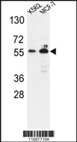 Western blot analysis of G6PD Antibody in K562,MCF-7 cell line lysates (35ug/lane)