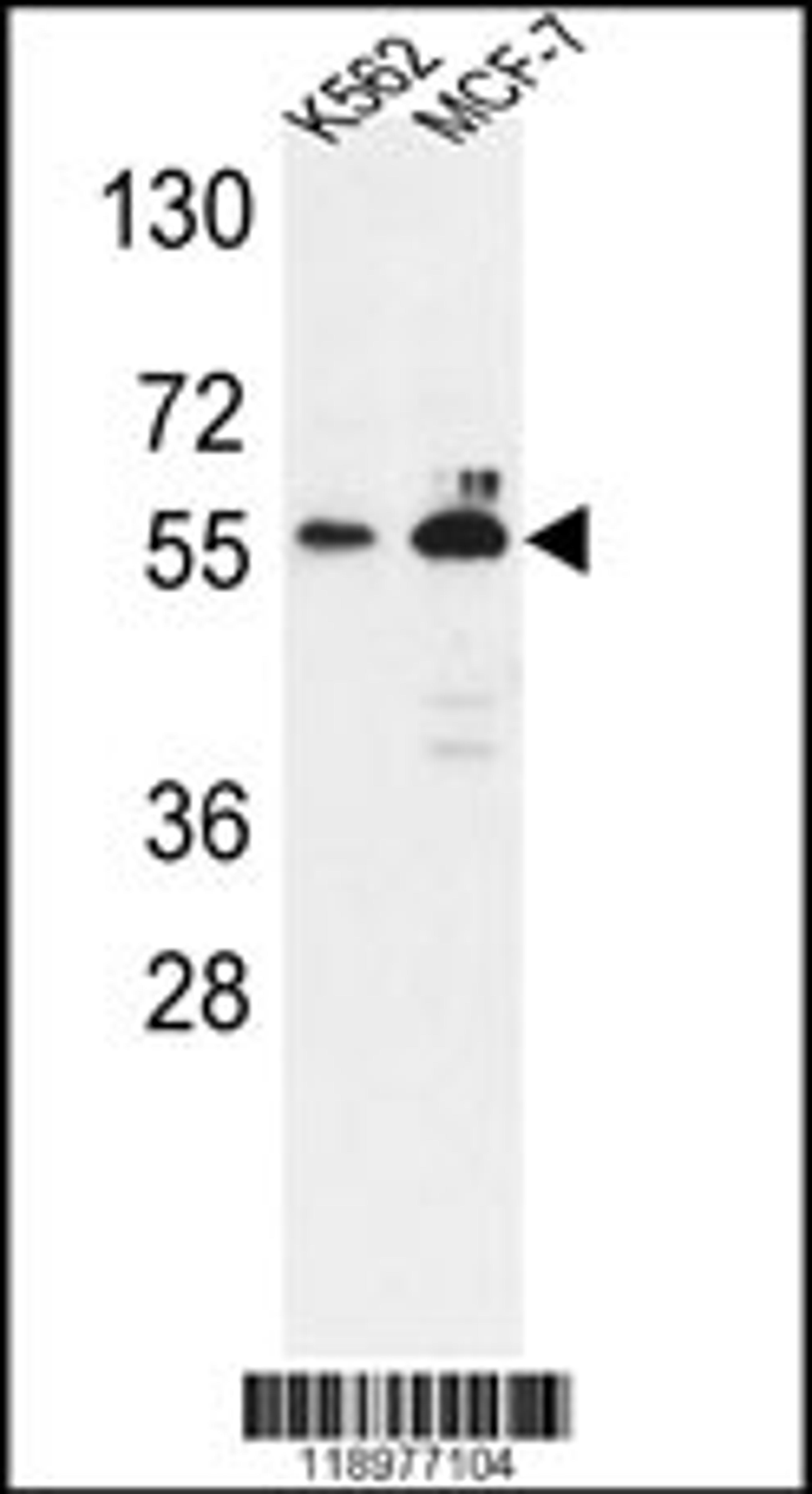 Western blot analysis of G6PD Antibody in K562,MCF-7 cell line lysates (35ug/lane)