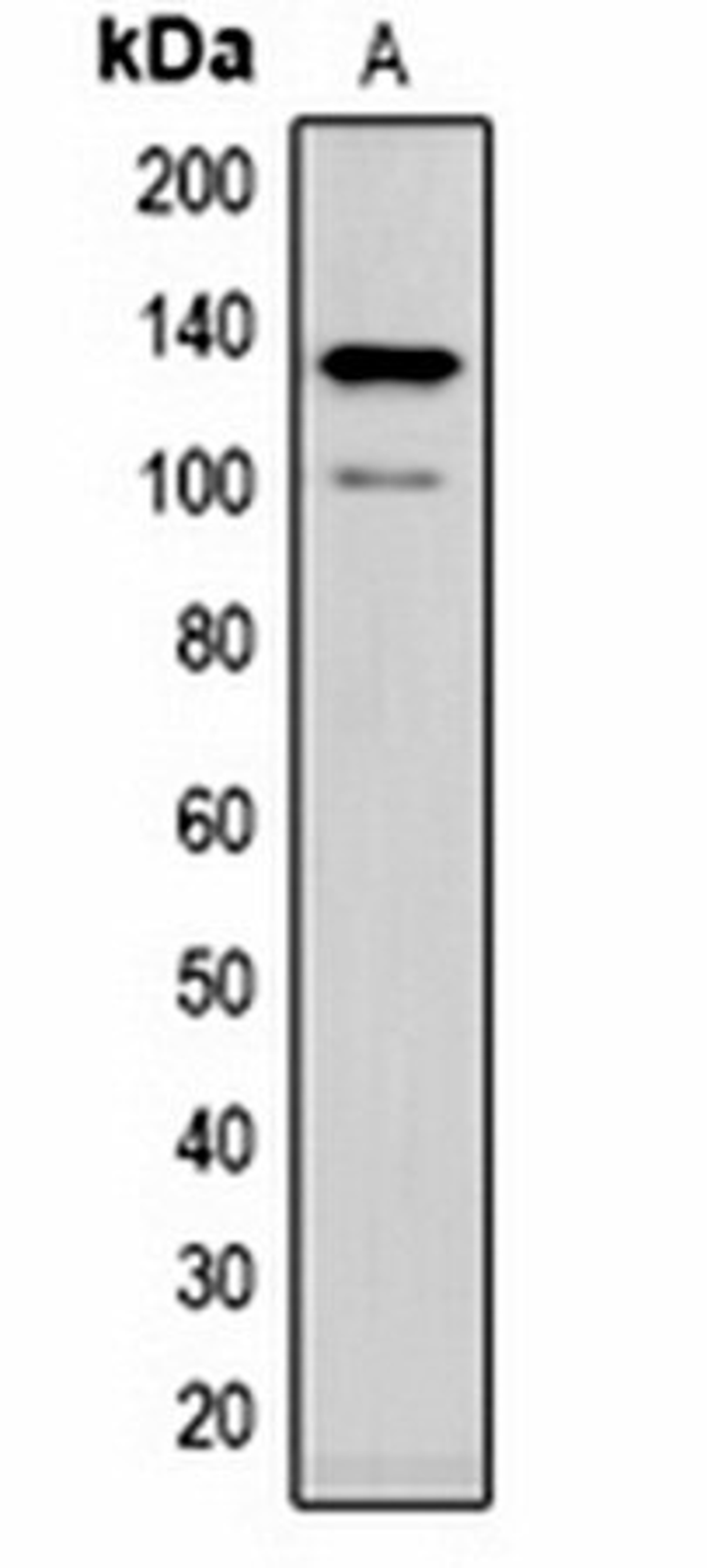 Western blot analysis of rat brain (Lane 1) whole cell lysates using CACNA2D1 antibody