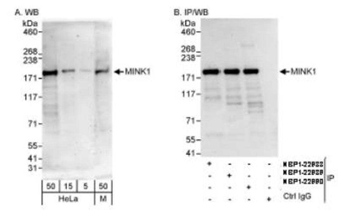 Western Blot: MAP4K6 Antibody [NBP1-22990] - Wole cell lysate from HeLa and mouse NIH3T3 cells at 0.04 mcg/ml (A) and 1 mcg/ml (B) and used for IP at 3 mcg/mg lysate.