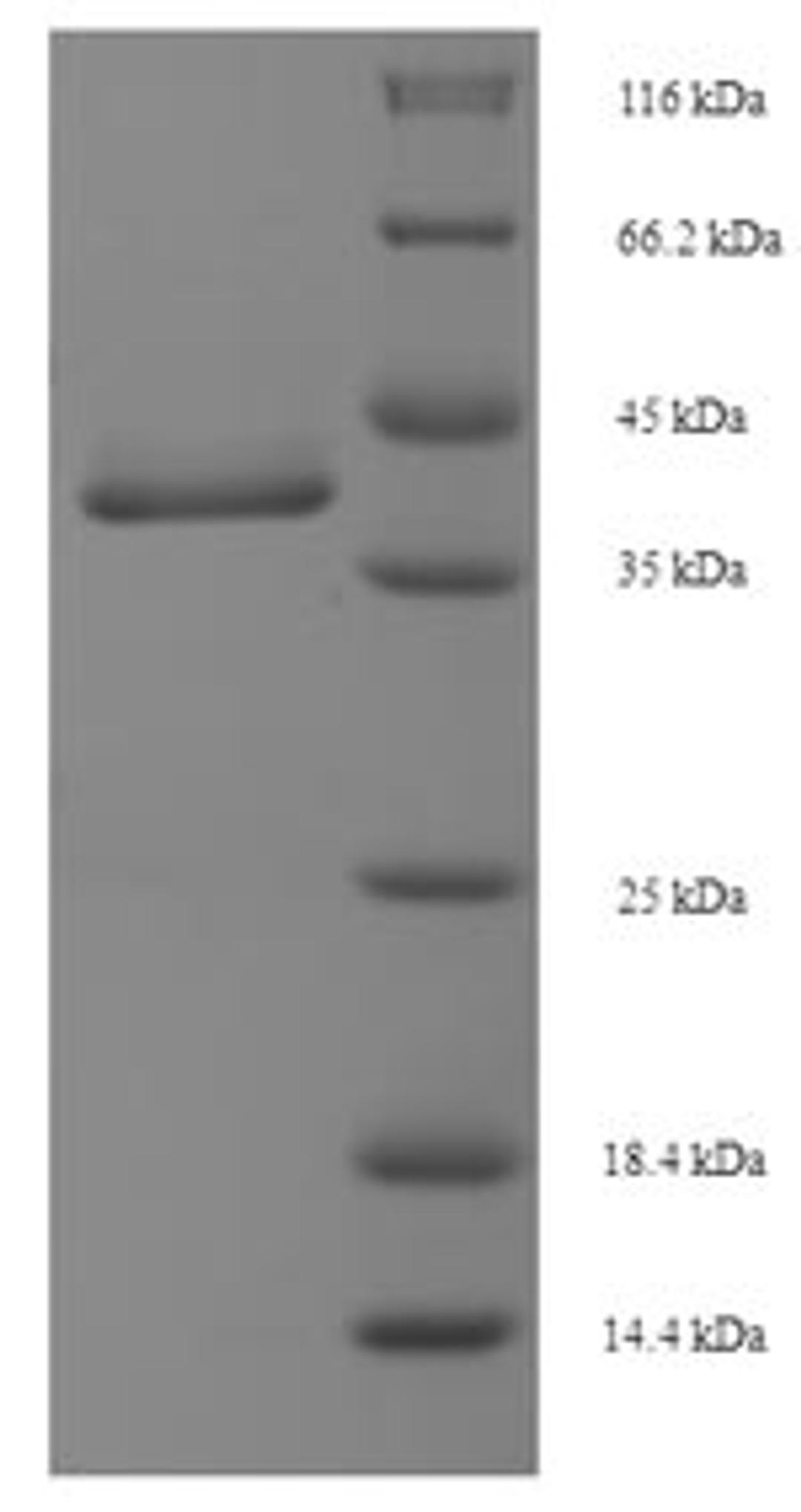 (Tris-Glycine gel) Discontinuous SDS-PAGE (reduced) with 5% enrichment gel and 15% separation gel.