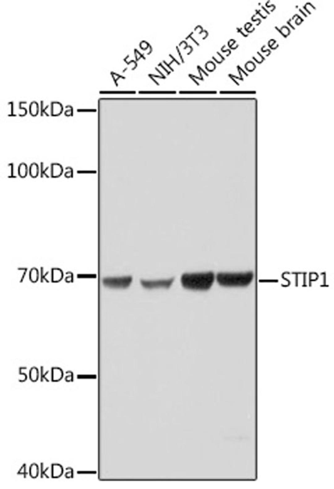 Western blot - STIP1 Rabbit mAb (A0036)