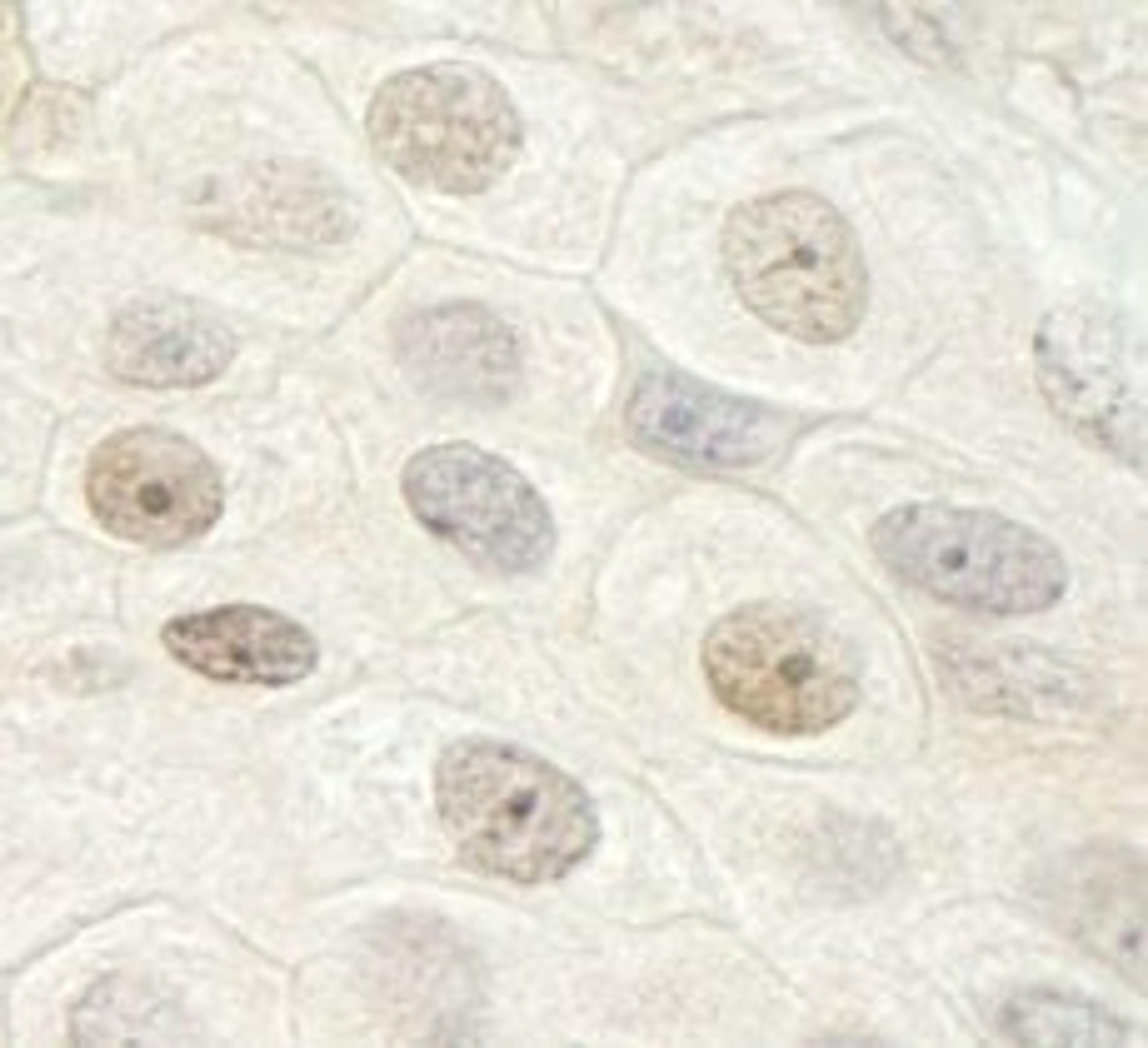 Detection of human DHX33 by immunohistochemistry.