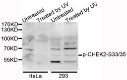 Western blot analysis of extracts of various cell lines using CHEK2 (Phospho-S33/35) antibody