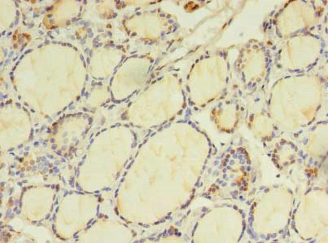 Immunohistochemistry of paraffin-embedded human thyroid tissue using CSB-PA883628LA01HU at dilution of 1:100