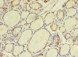 Immunohistochemistry of paraffin-embedded human thyroid tissue using CSB-PA883628LA01HU at dilution of 1:100