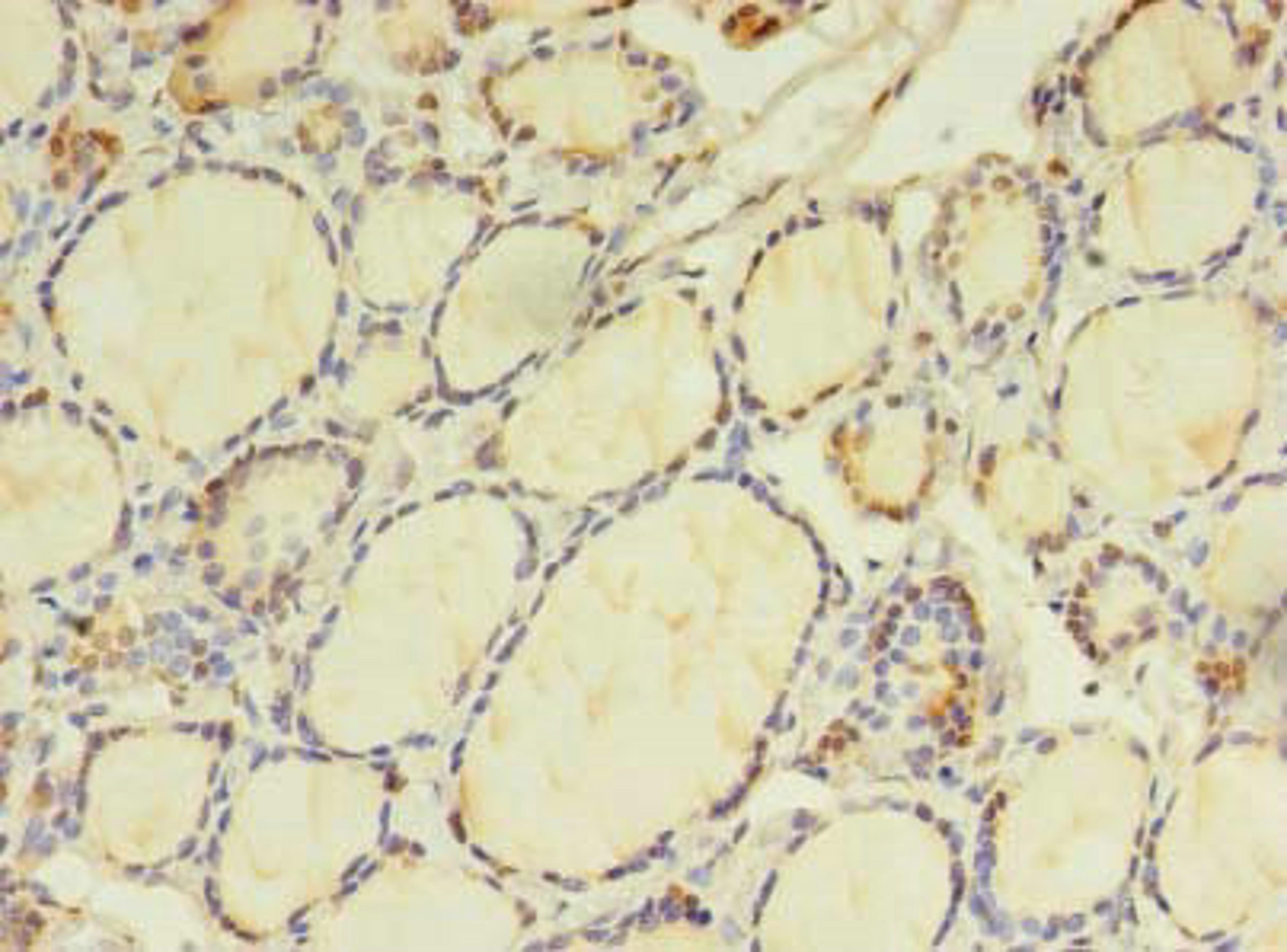 Immunohistochemistry of paraffin-embedded human thyroid tissue using CSB-PA883628LA01HU at dilution of 1:100