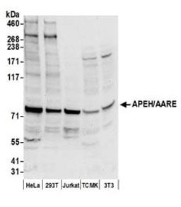 Detection of human and mouse APEH/AARE by western blot.