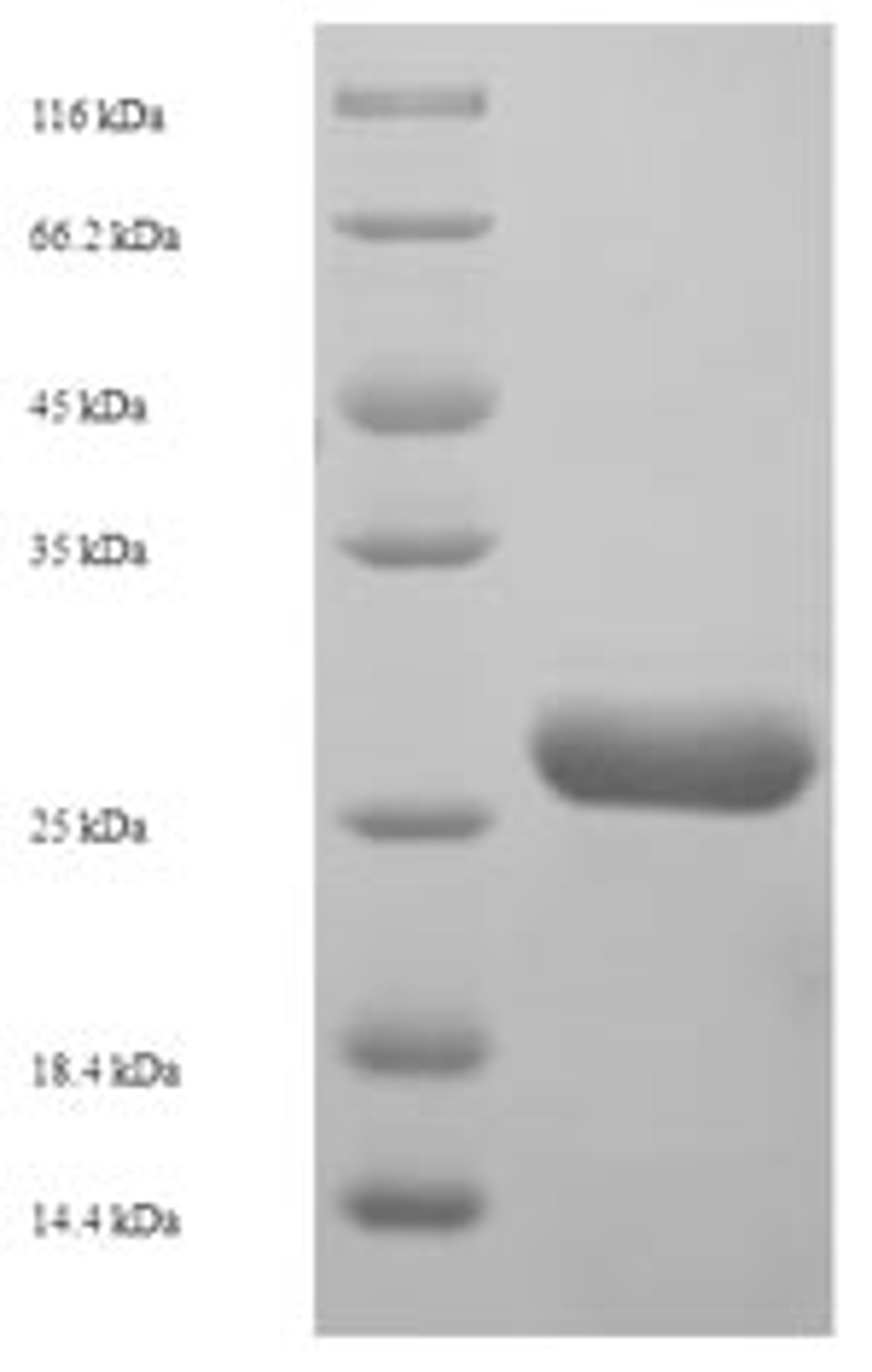 (Tris-Glycine gel) Discontinuous SDS-PAGE (reduced) with 5% enrichment gel and 15% separation gel.