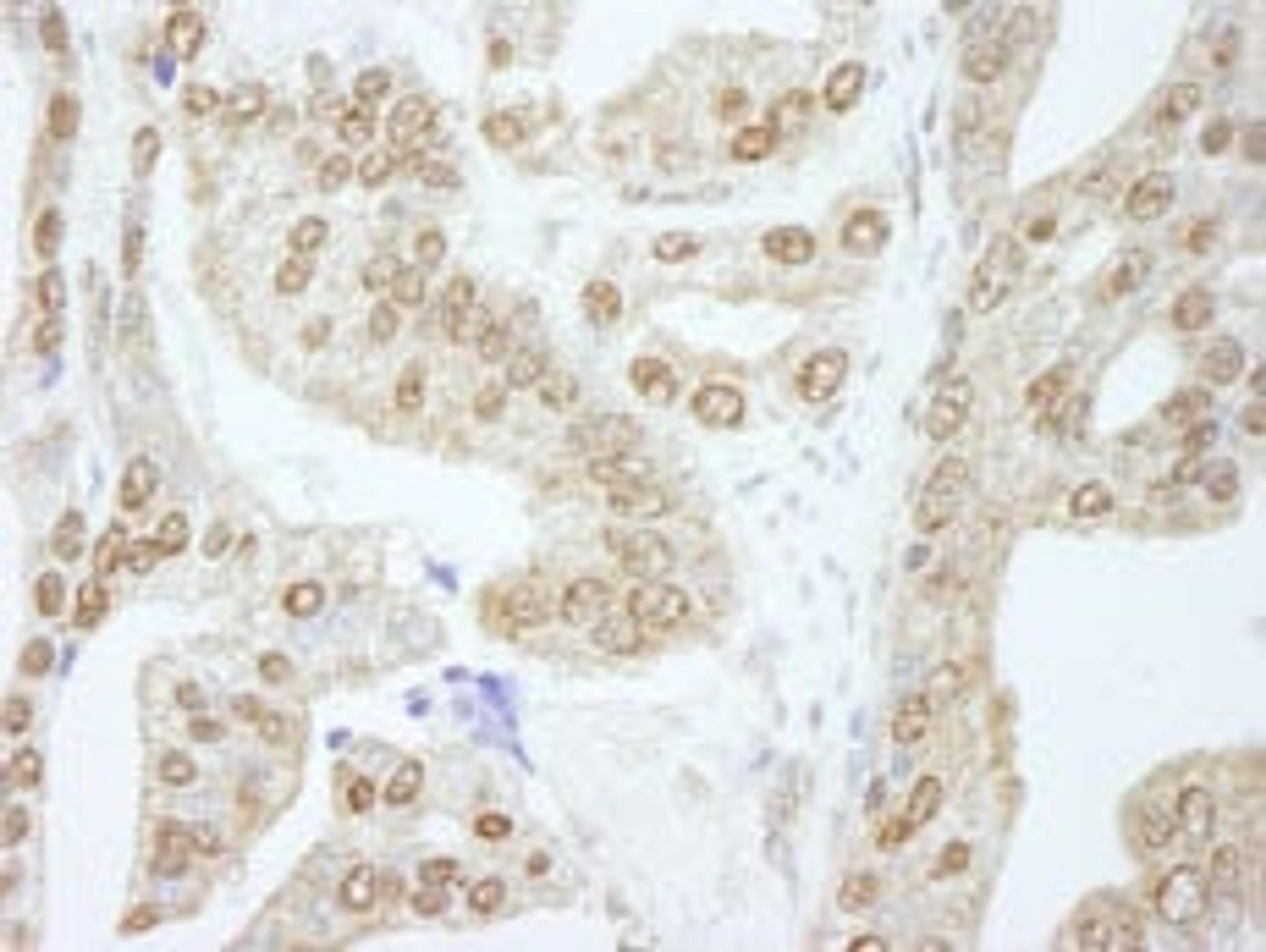 Detection of human Cyclin E1 by immunohistochemistry.