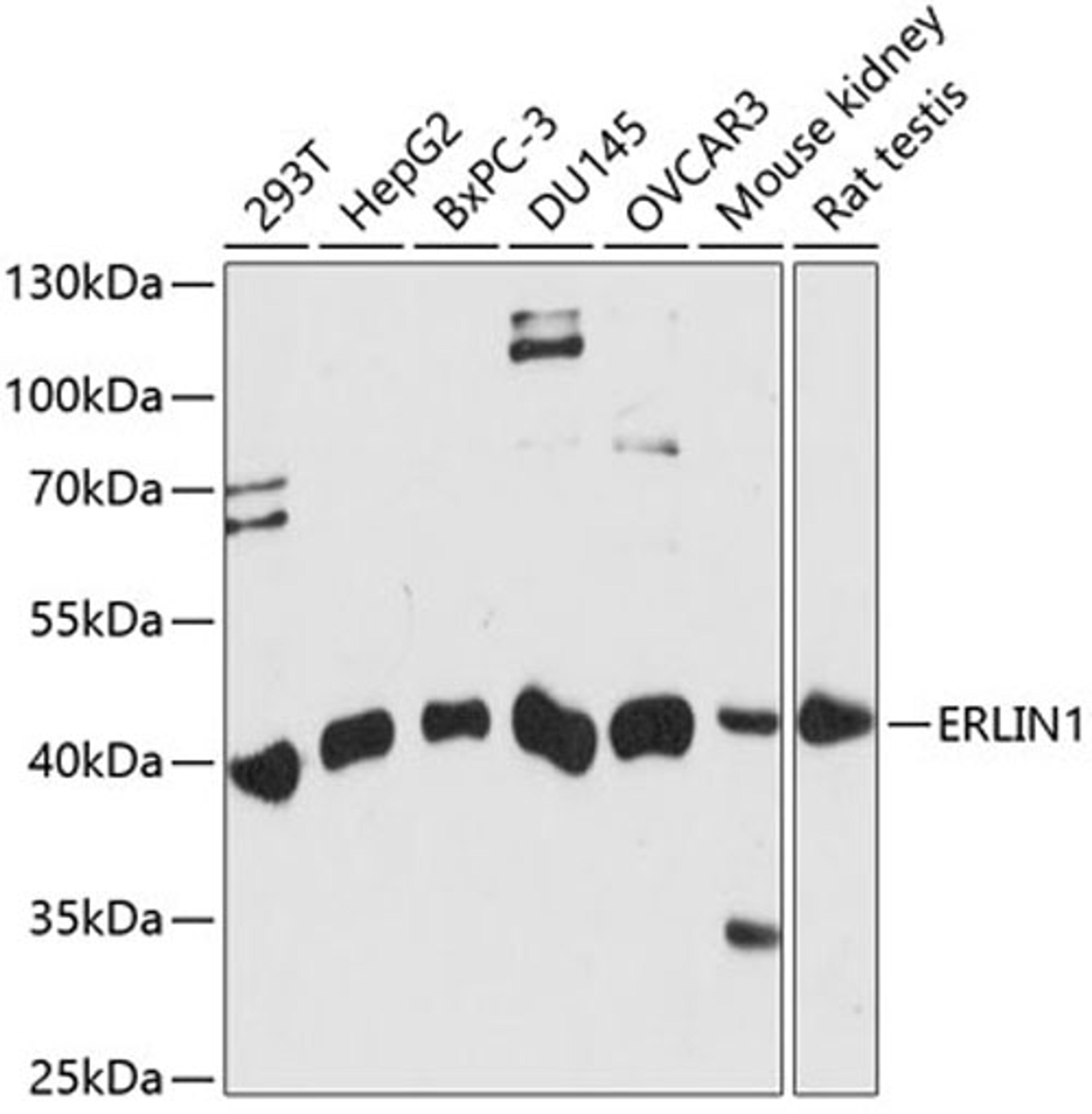 Western blot - ERLIN1 antibody (A14843)