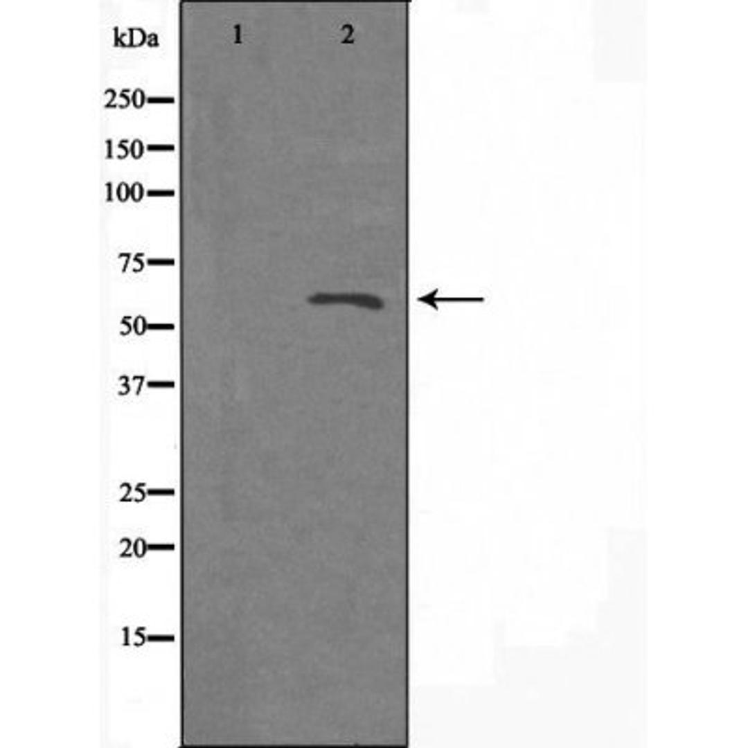 Western blot analysis of Jurkat cells using A26B1 antibody