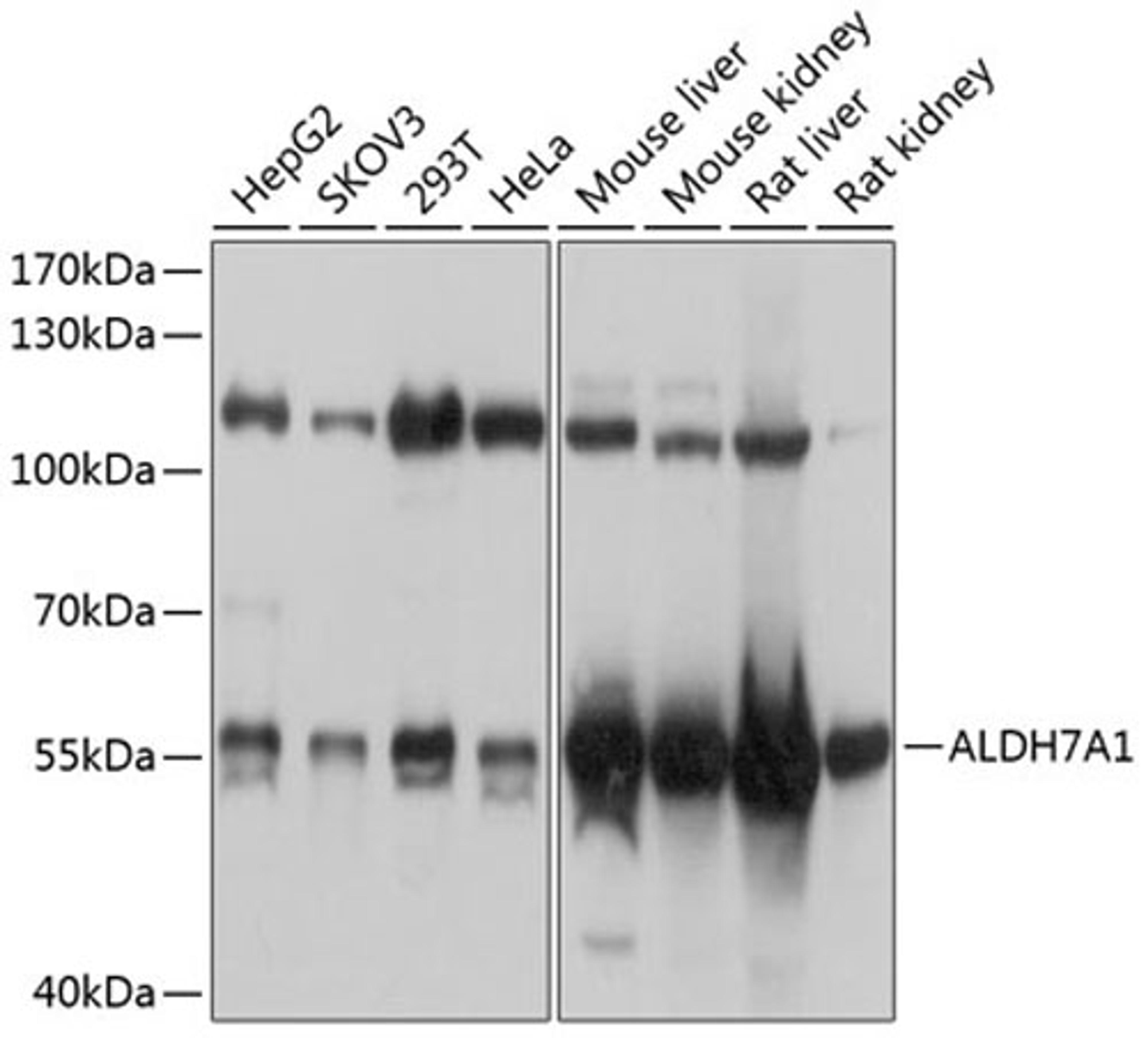 Western blot - ALDH7A1 antibody (A8629)