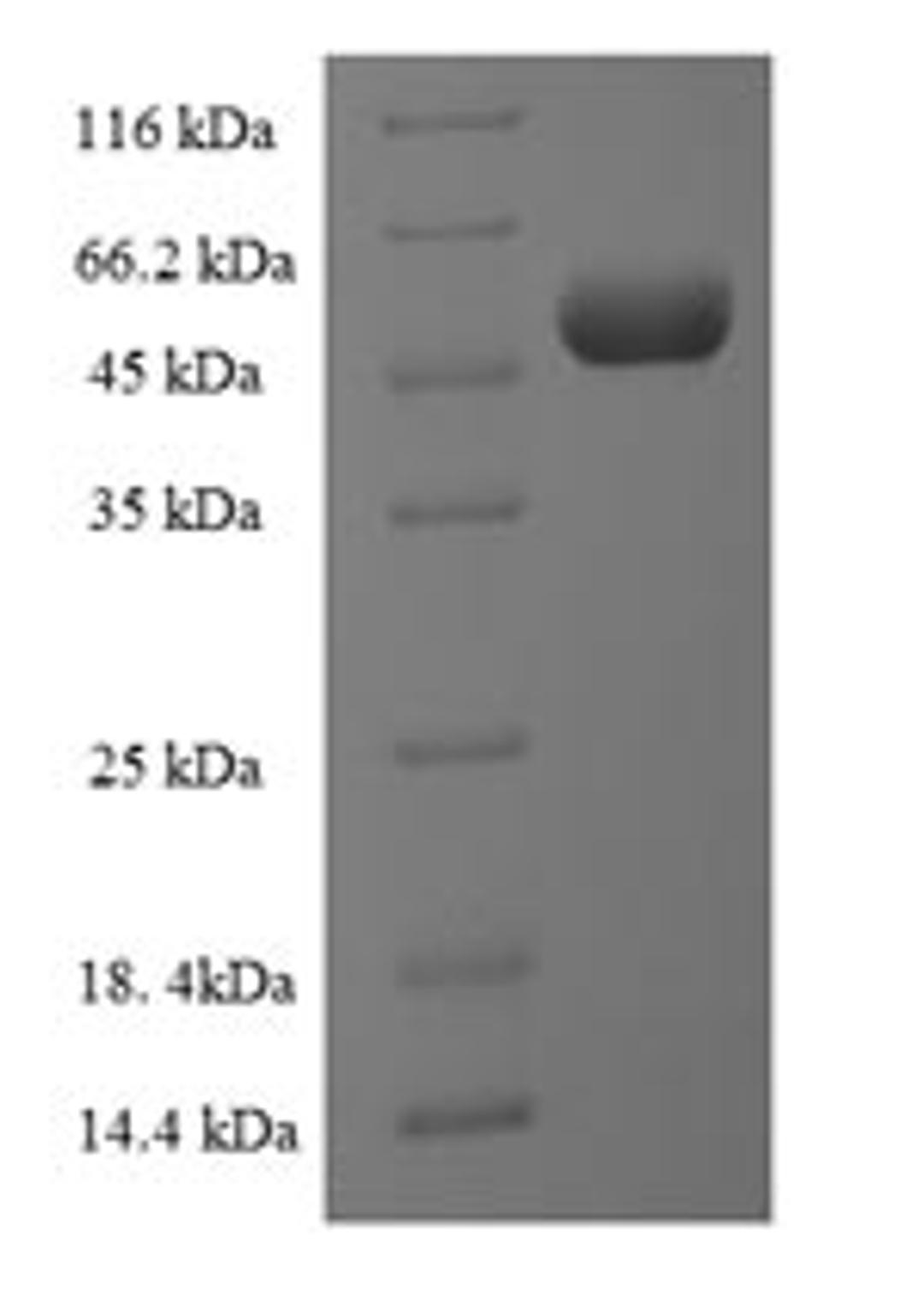 (Tris-Glycine gel) Discontinuous SDS-PAGE (reduced) with 5% enrichment gel and 15% separation gel.
