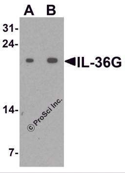 Western blot analysis of IL-36G in human spleen tissue lysate with IL-36G antibody at (A) 1 and (B) 2 &#956;g/ml.