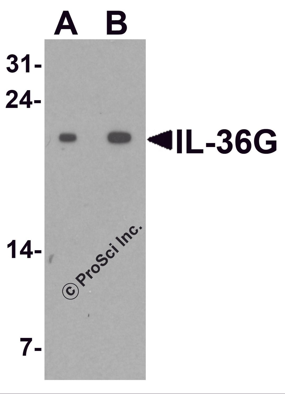 Western blot analysis of IL-36G in human spleen tissue lysate with IL-36G antibody at (A) 1 and (B) 2 μg/ml.