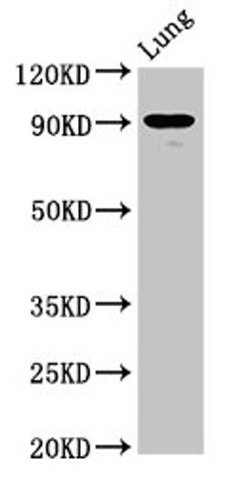 Western Blot. Positive WB detected in: Rat luing tissue. All lanes: SEMA4B antibody at 6.3ug/ml. Secondary. Goat polyclonal to rabbit IgG at 1/50000 dilution. Predicted band size: 93, 82 kDa. Observed band size: 93 kDa.