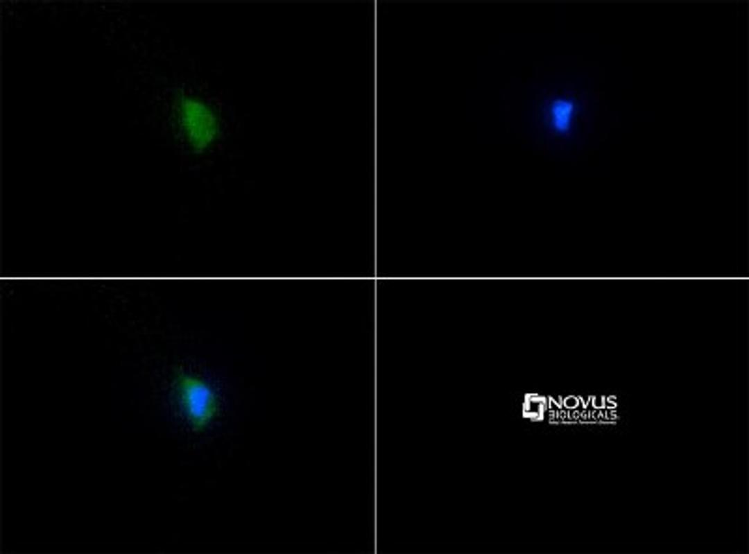 Immunocytochemistry/Immunofluorescence: SERF2 Antibody [NBP1-78375] - Staining of SERF2 antibody tested in HUVEC cells with FITC (green). Nuclei were counterstained with Dapi (blue).