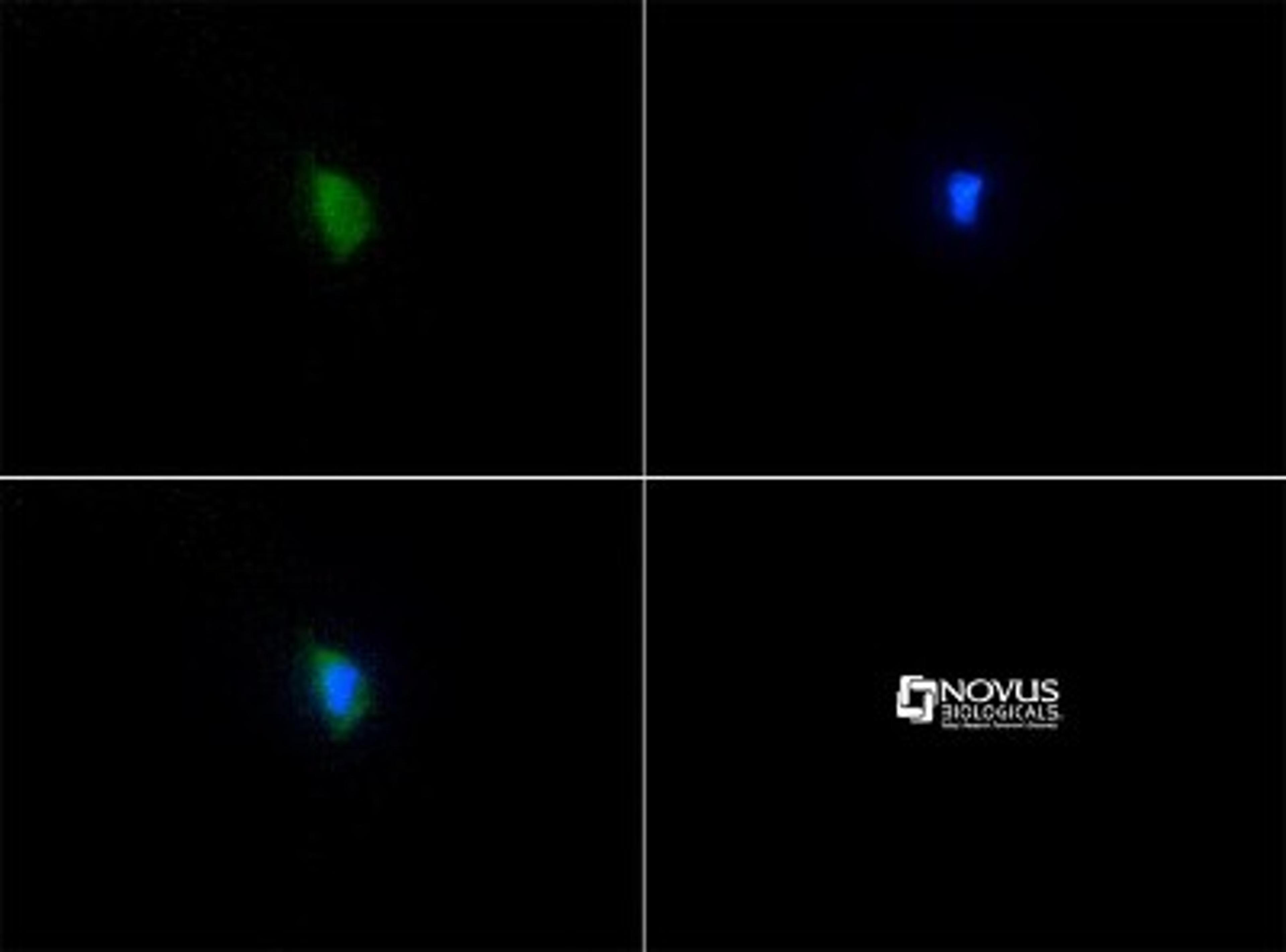 Immunocytochemistry/Immunofluorescence: SERF2 Antibody [NBP1-78375] - Staining of SERF2 antibody tested in HUVEC cells with FITC (green). Nuclei were counterstained with Dapi (blue).