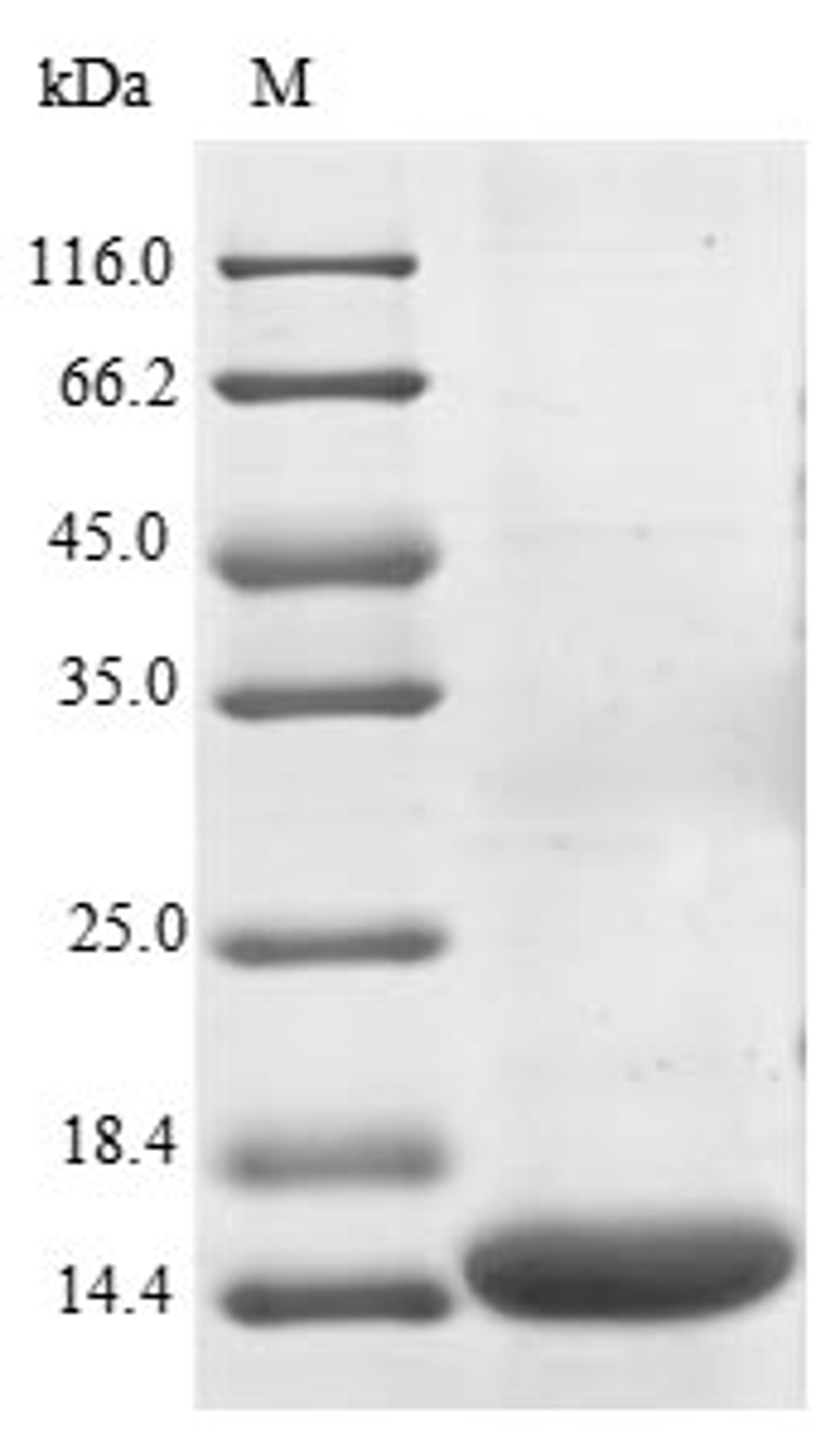 (Tris-Glycine gel) Discontinuous SDS-PAGE (reduced) with 5% enrichment gel and 15% separation gel.