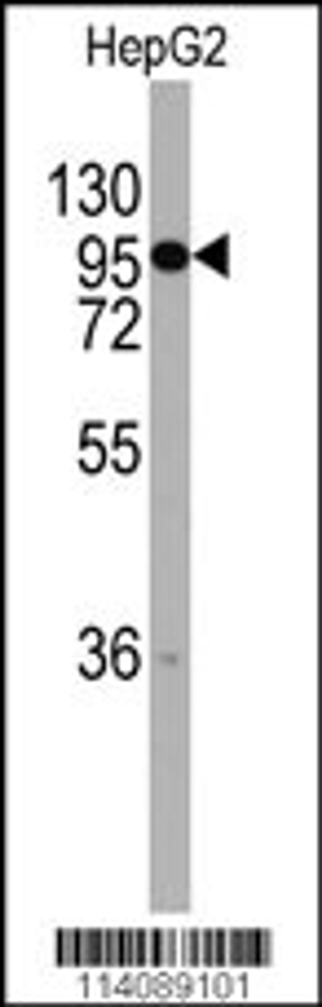 Western blot analysis of anti-CHRD Antibody in HepG2 cell line lysates (35ug/lane)