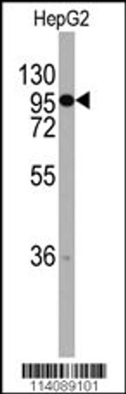 Western blot analysis of anti-CHRD Antibody in HepG2 cell line lysates (35ug/lane)