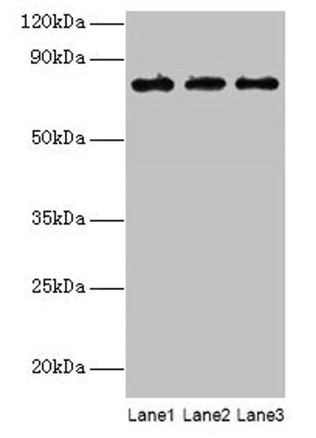 Western blot. All lanes: KIRREL2 antibody at 8µg/ml. Lane 1: Mouse gonadal tissue. Lane 2: Mouse lung tissue. Lane 3: Mouse heart tissue. Secondary. Goat polyclonal to rabbit IgG at 1/10000 dilution. Predicted band size: 76, 68, 62, 24 kDa. Observed band size: 76 kDa