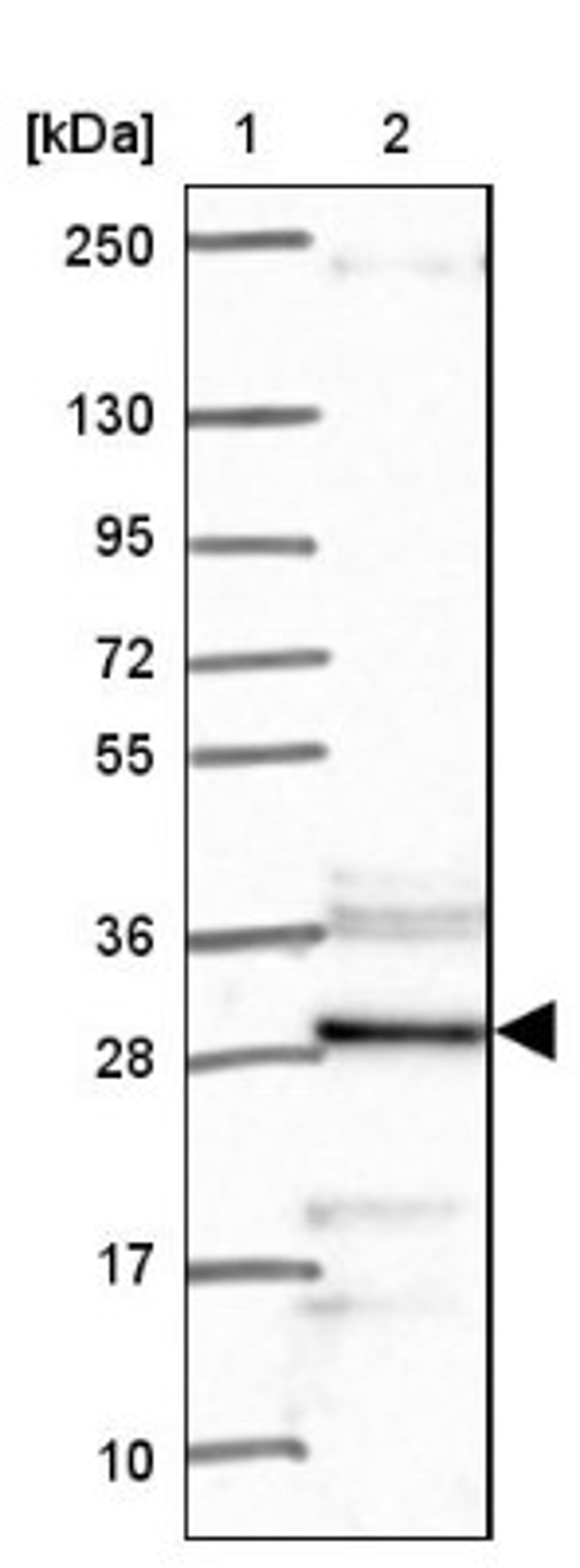 Western Blot: Calpain S2 Antibody [NBP2-34140] - Lane 1: Marker [kDa] 250, 130, 95, 72, 55, 36, 28, 17, 10<br/>Lane 2: Human cell line RT-4