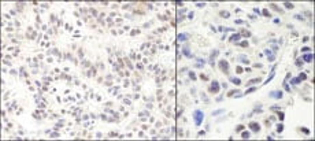 Detection of human and mouse HMG2a by immunohistochemistry.