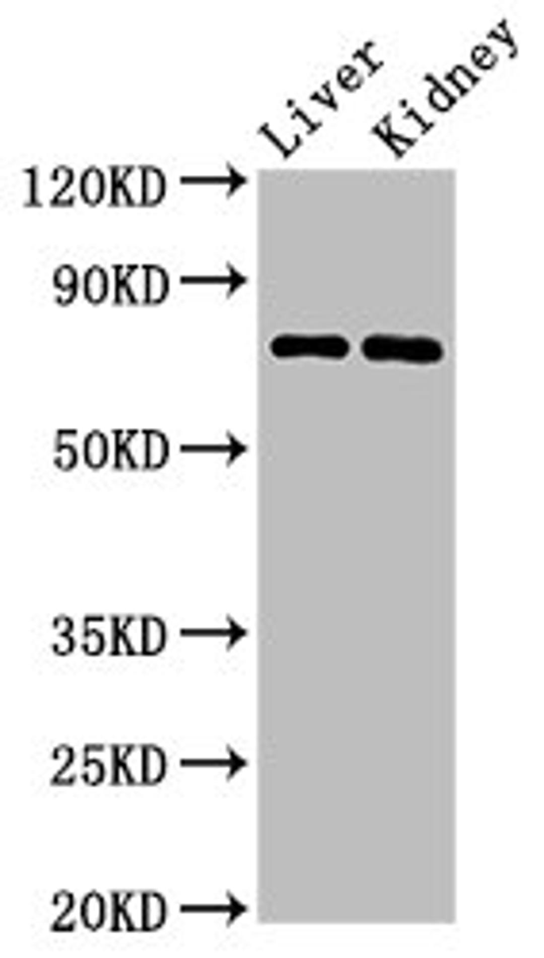 Western Blot. Positive WB detected in: Mouse liver tissue, Mouse kidney tissue. All lanes: PRDM5 antibody at 3ug/ml. Secondary. Goat polyclonal to rabbit IgG at 1/50000 dilution. Predicted band size: 74, 70, 13, 59 kDa. Observed band size: 74 kDa.