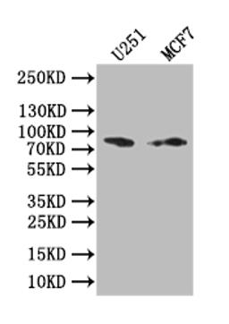 Western Blot. Positive WB detected in: U251 whole cell lysate, MCF7 whole cell lysate. All lanes: GSN antibody at 1:1000. Secondary. Goat polyclonal to rabbit IgG at 1/50000 dilution. Predicted band size: 85 kDa. Observed band size: 85 kDa. 
