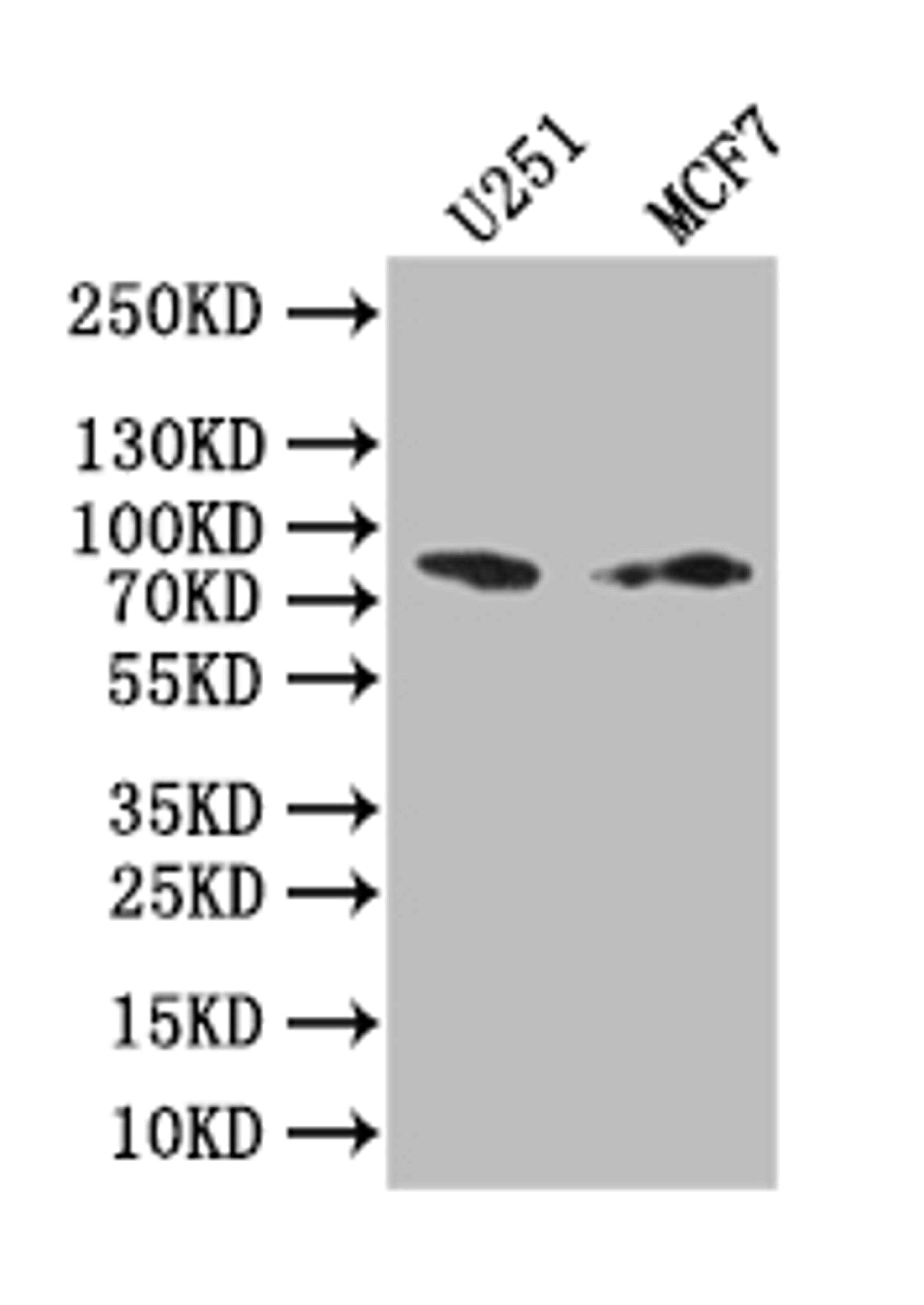 Western Blot. Positive WB detected in: U251 whole cell lysate, MCF7 whole cell lysate. All lanes: GSN antibody at 1:1000. Secondary. Goat polyclonal to rabbit IgG at 1/50000 dilution. Predicted band size: 85 kDa. Observed band size: 85 kDa. 