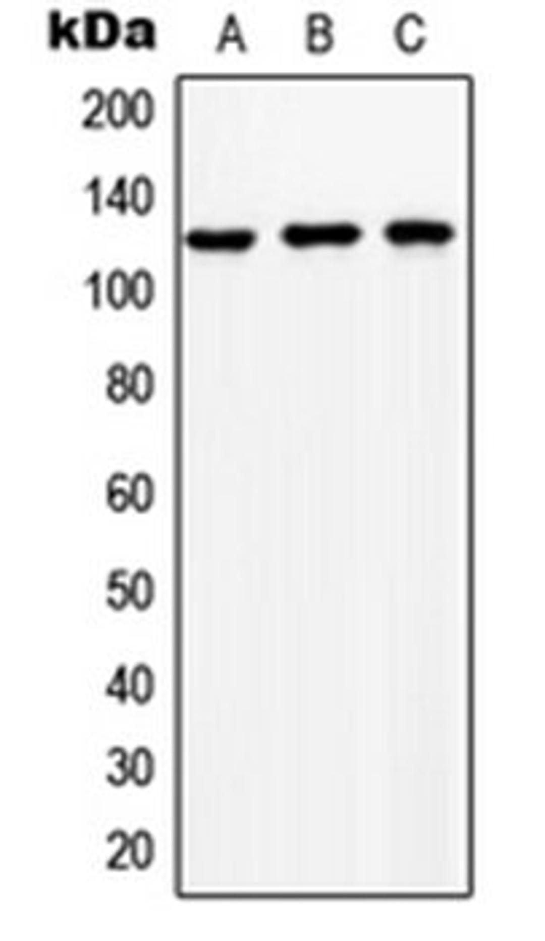 Western blot analysis of HeLa (Lane 1), SP2/0 (Lane 2), NIH3T3 (Lane 3) whole cell lysates using SLC24A1 antibody