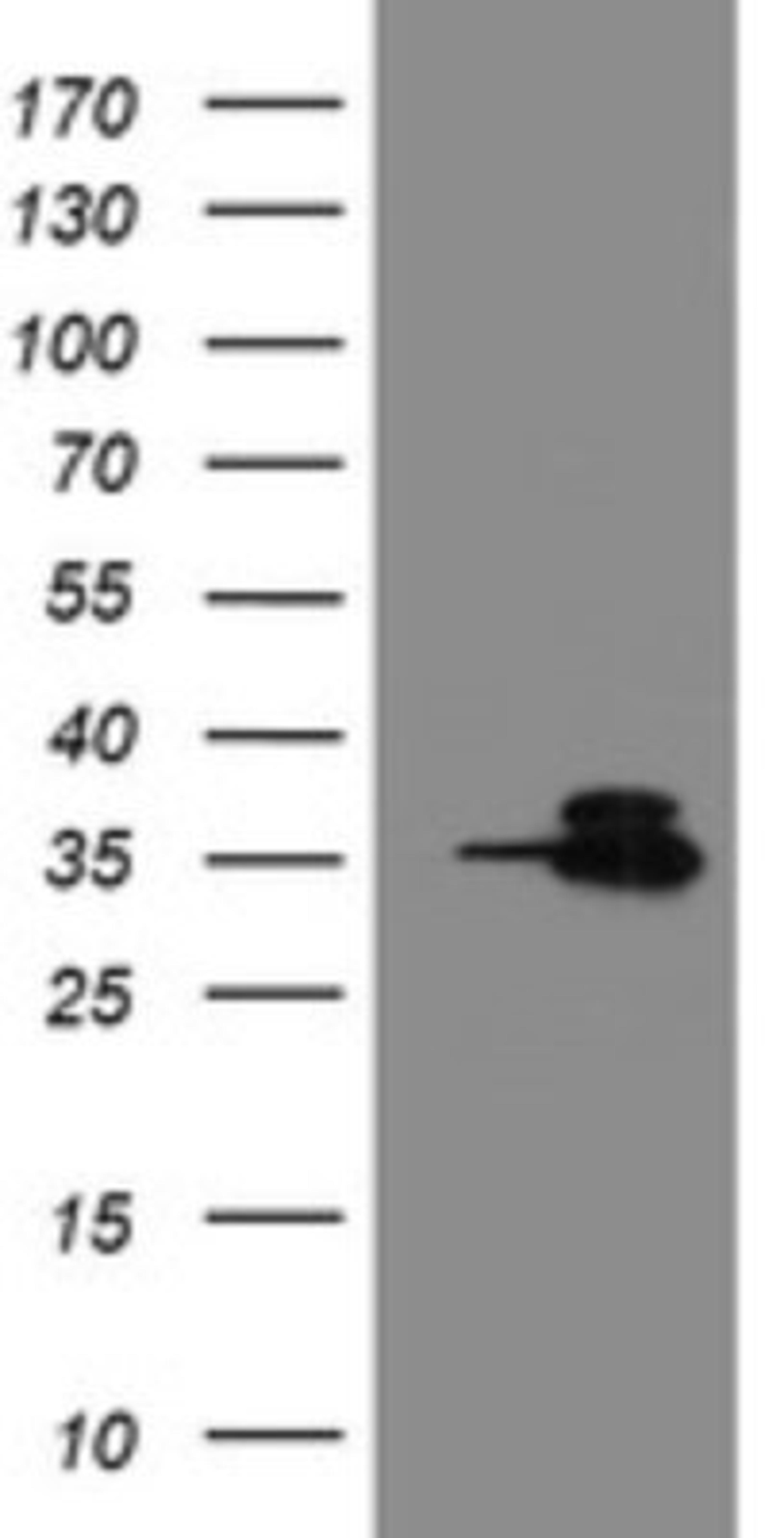 Western Blot: Otubain-1 Antibody (5B8) [NBP2-45879] - Analysis of HEK293T cells were transfected with the pCMV6-ENTRY control (Left lane) or pCMV6-ENTRY Otubain-1.