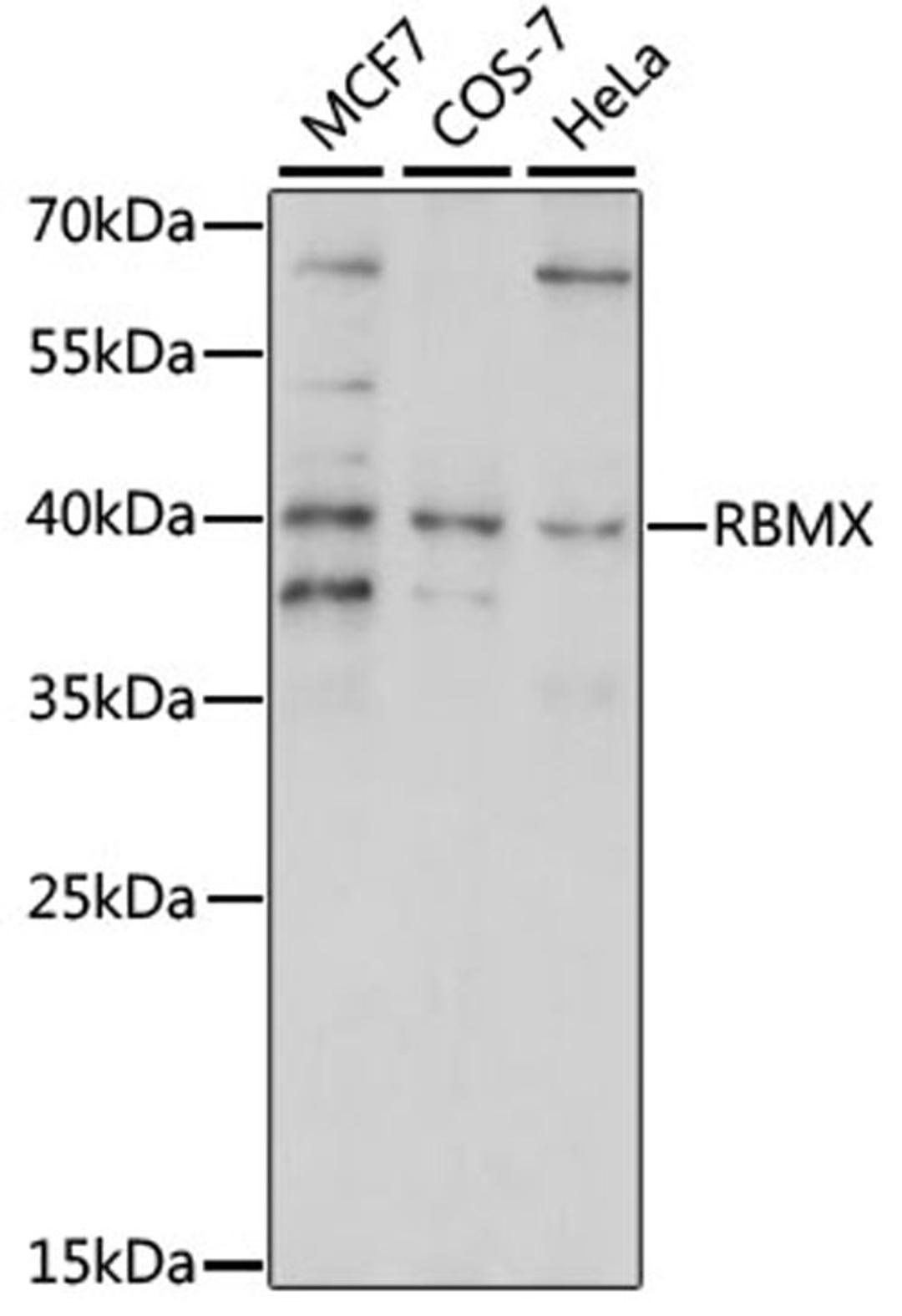 Western blot - RBMX antibody (A15436)