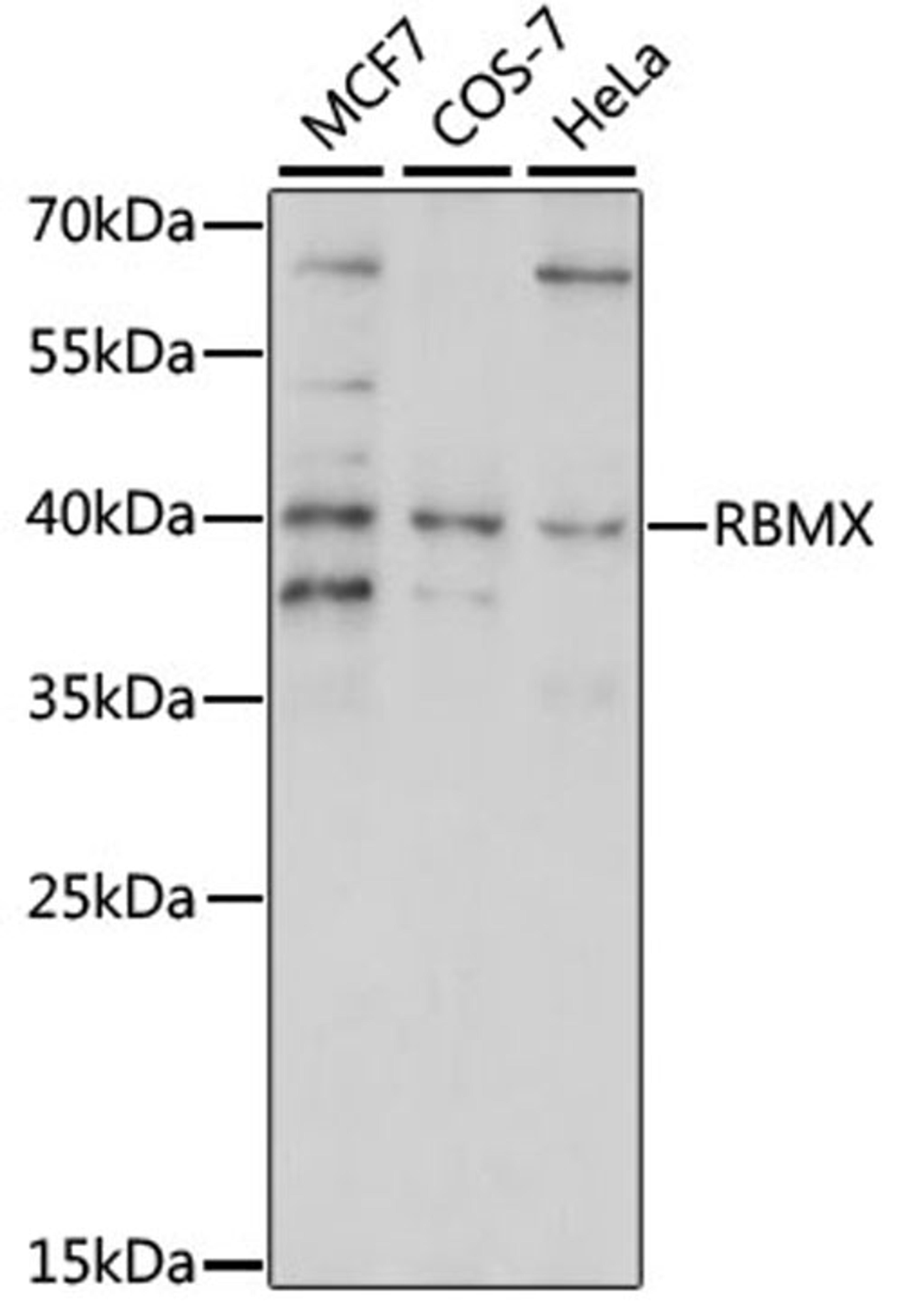 Western blot - RBMX antibody (A15436)