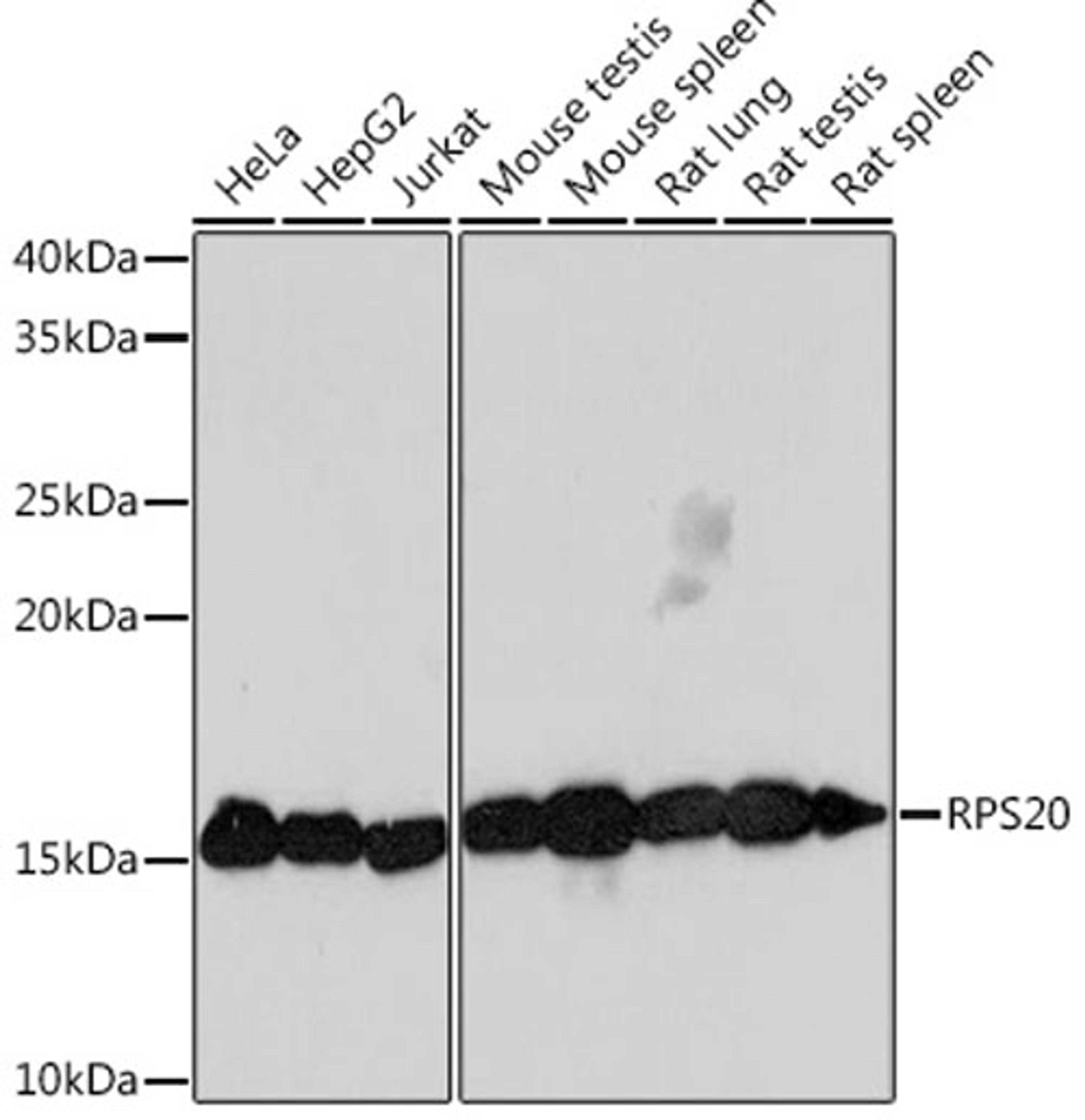 Western blot - RPS20 Rabbit mAb (A9551)