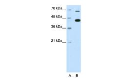 Antibody used in WB on Human HepG2 at 0.2-1 ug/ml.