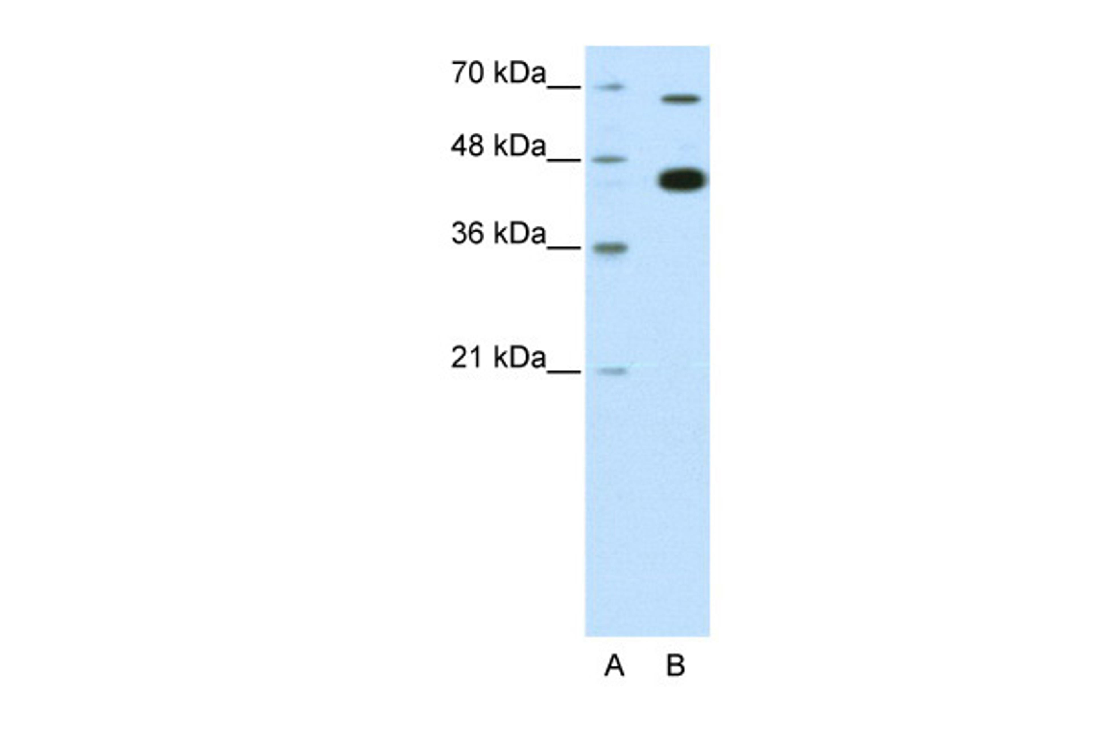 Antibody used in WB on Human HepG2 at 0.2-1 ug/ml.