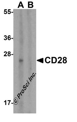 Western blot analysis of CD28 in human spleen tissue lysate with CD28 antibody at 1 μg/mL in (A) the absence and (B) the presence of blocking peptide.