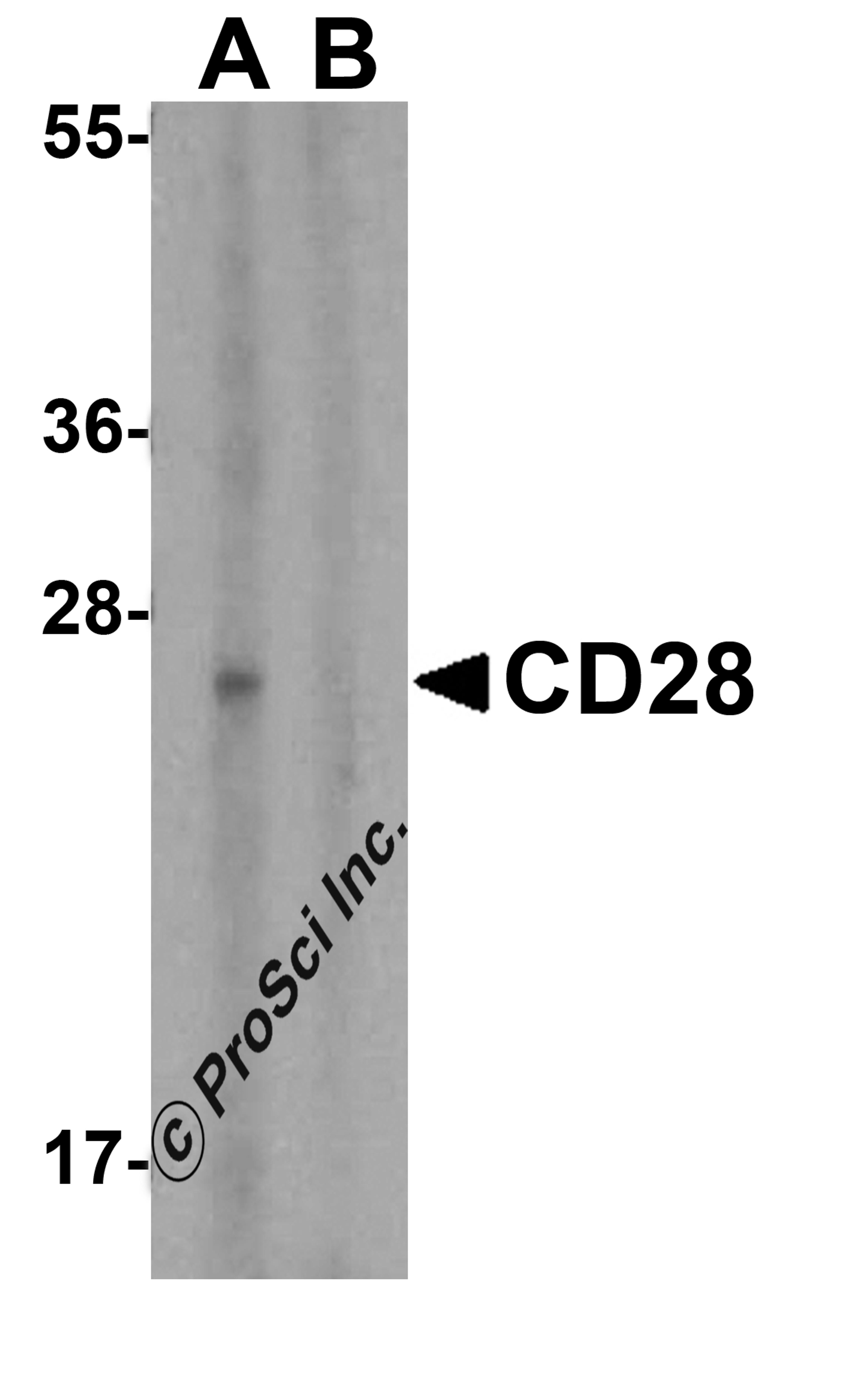 Western blot analysis of CD28 in human spleen tissue lysate with CD28 antibody at 1 μg/mL in (A) the absence and (B) the presence of blocking peptide.